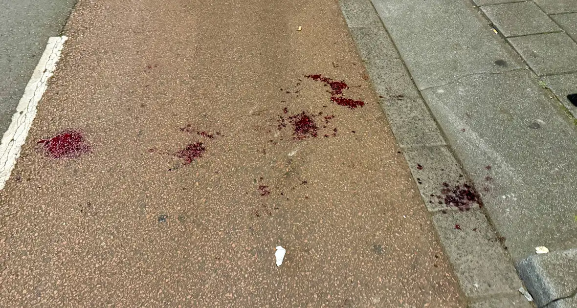 Fietser gewond na val, buurt maakt zich zorgen over veiligheid door tramrails - Foto 4