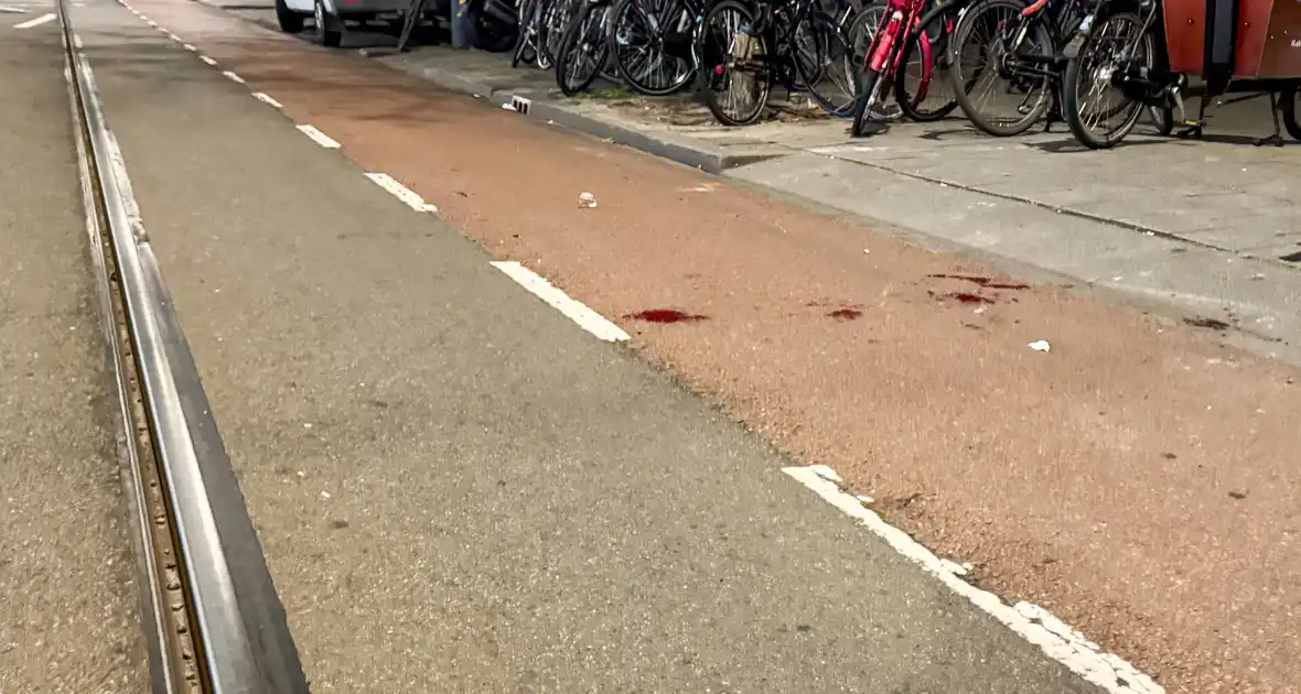 Fietser gewond na val, buurt maakt zich zorgen over veiligheid door tramrails - Foto 5
