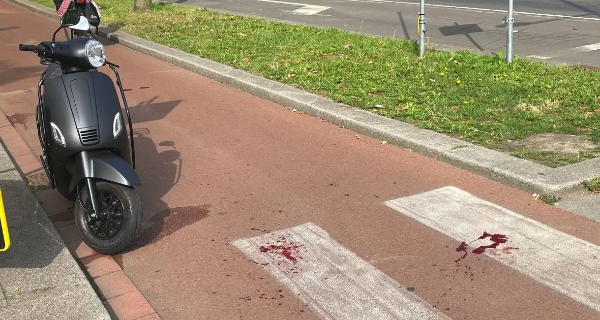 Zwaargewonden na botsing tussen fietser en scooter - Foto 4
