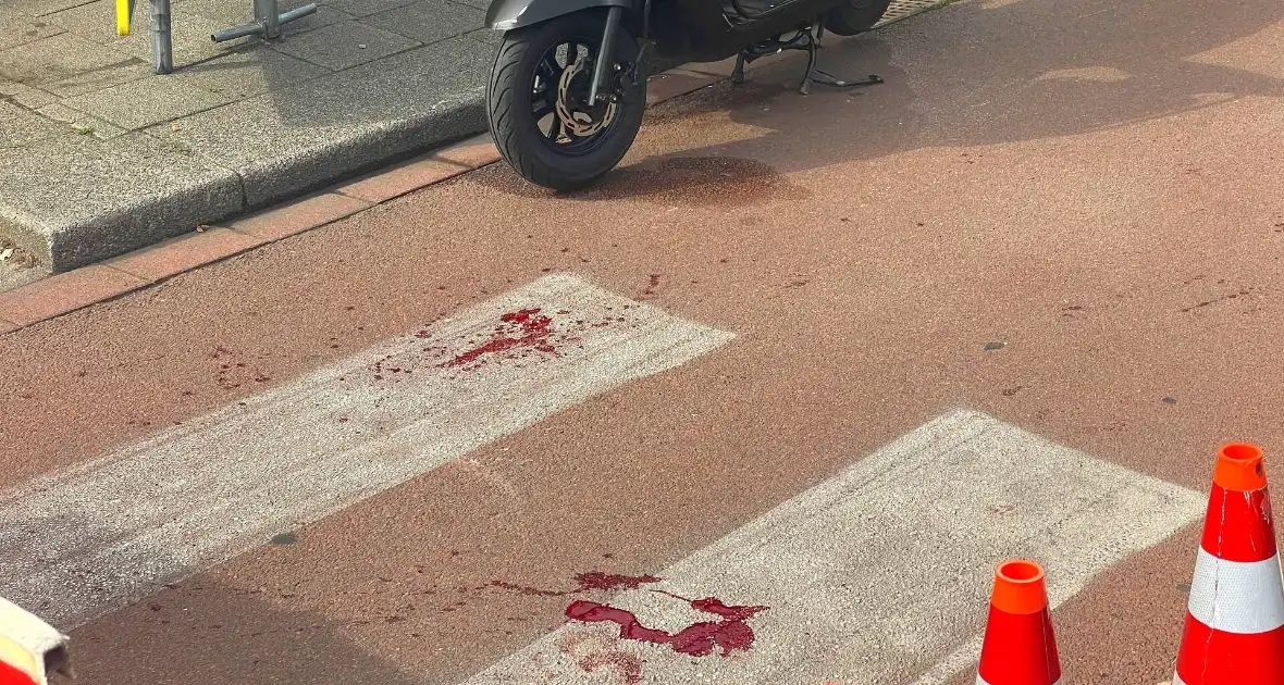 Zwaargewonden na botsing tussen fietser en scooter - Foto 6