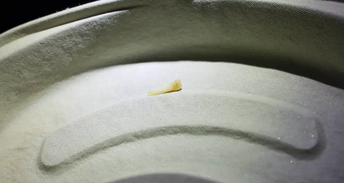 Fietser vliegt door rood bij Pompenburg en verliest tanden na harde botsing - Foto 3