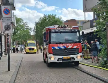 Brand in woning leidt tot brandwonden